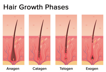 Genetic Hair Loss Explained: Why Androgenetic Alopecia Happens & What You Can Do
