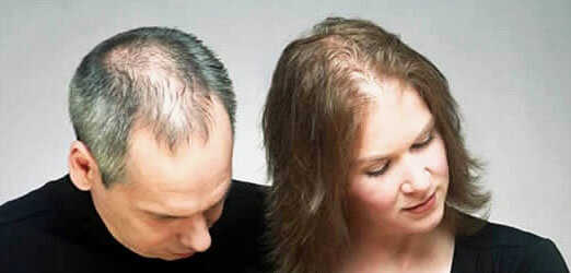 What is alopecia? Here's what you can do to help!